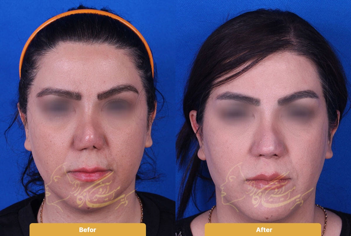 Before and after image