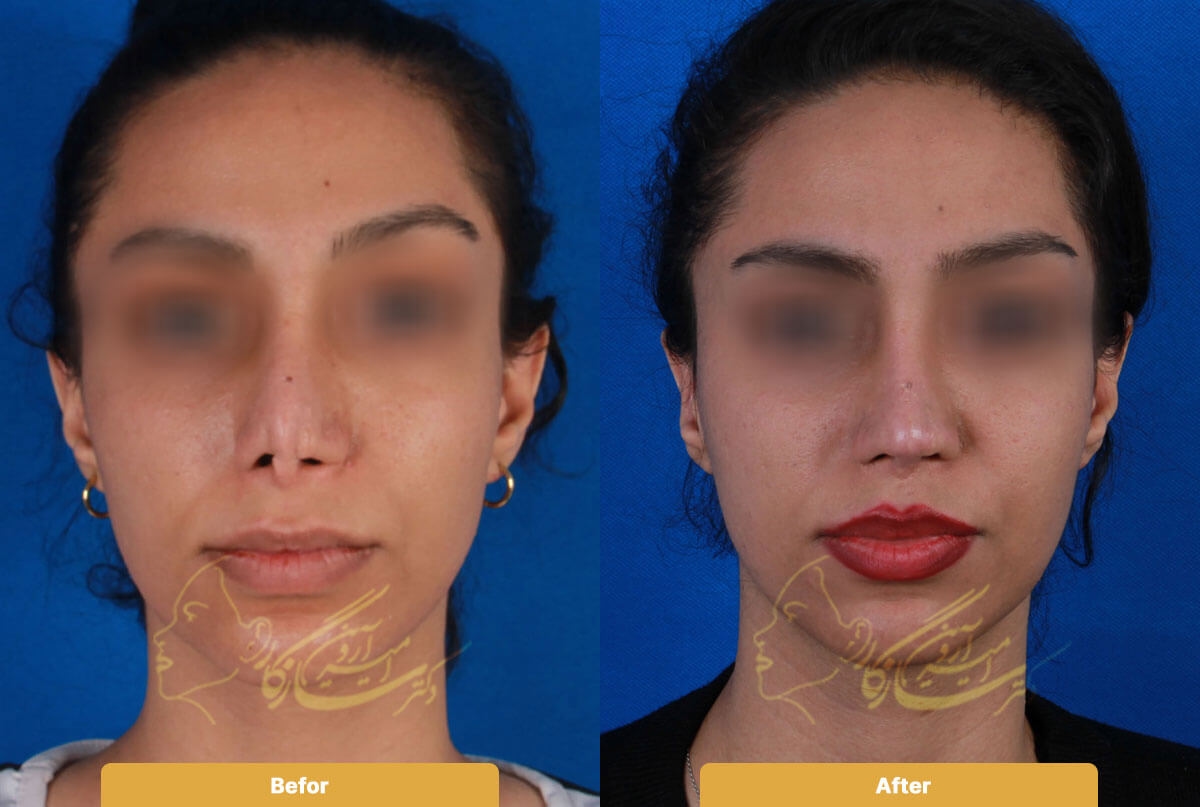 Before and after image