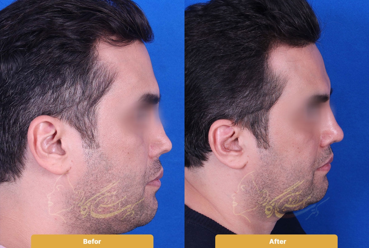 Before and after image