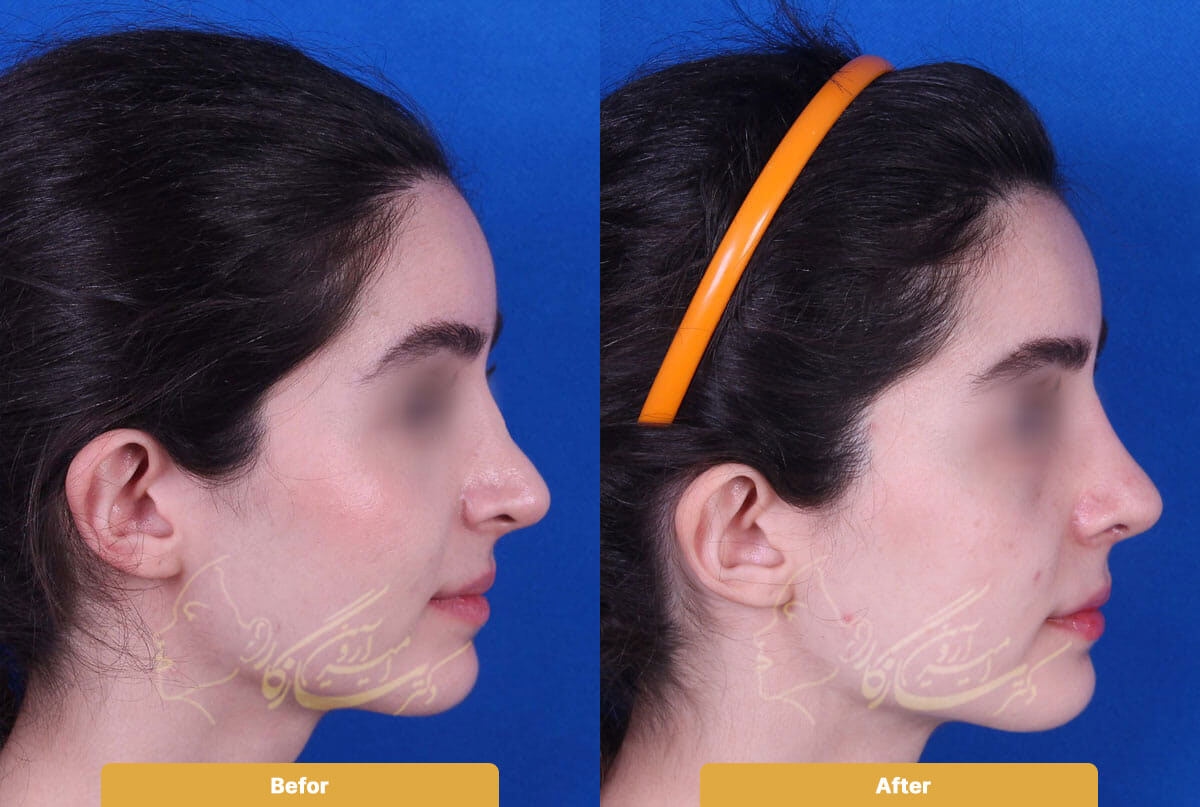 Before and after image