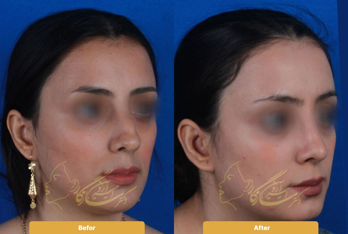 Before and after image