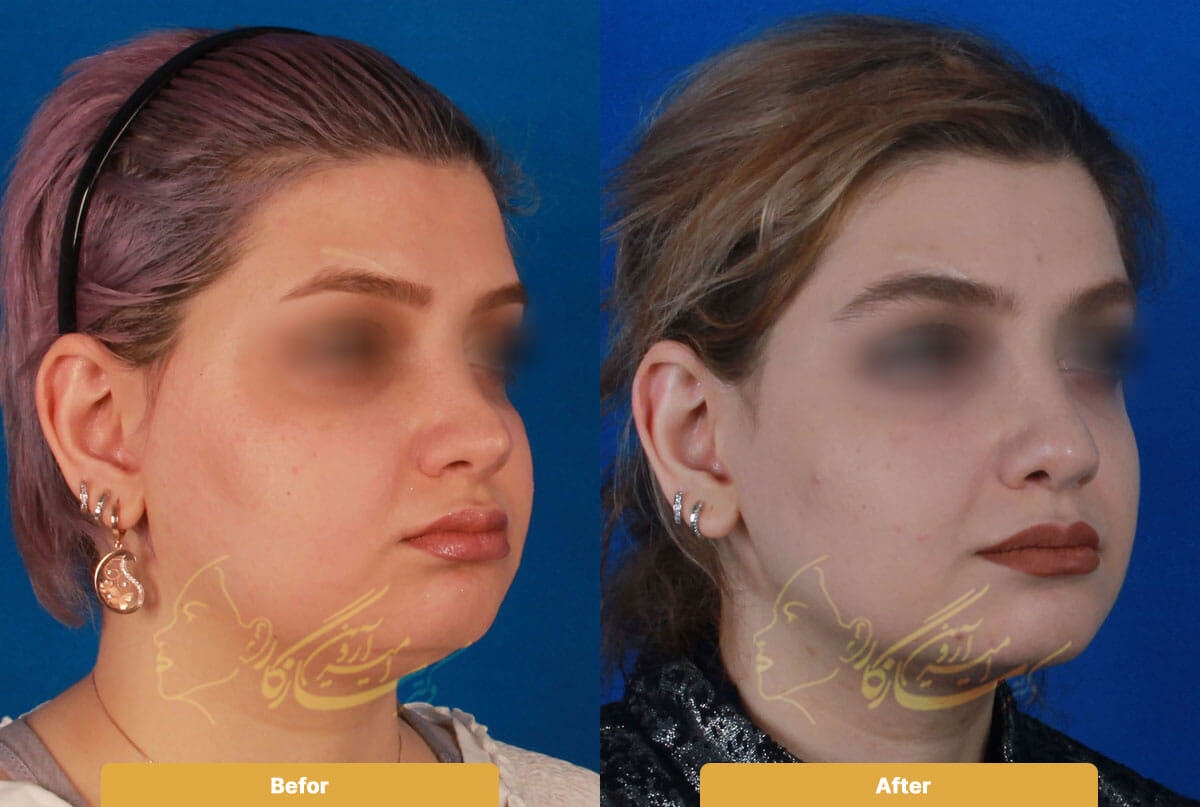 Before and after image