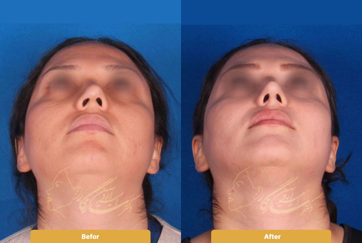 Before and after image