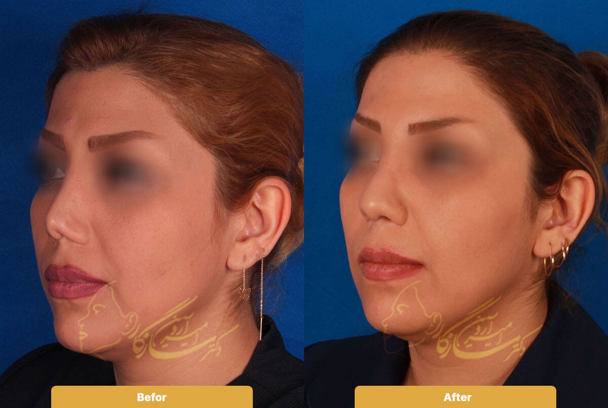 Before and after image