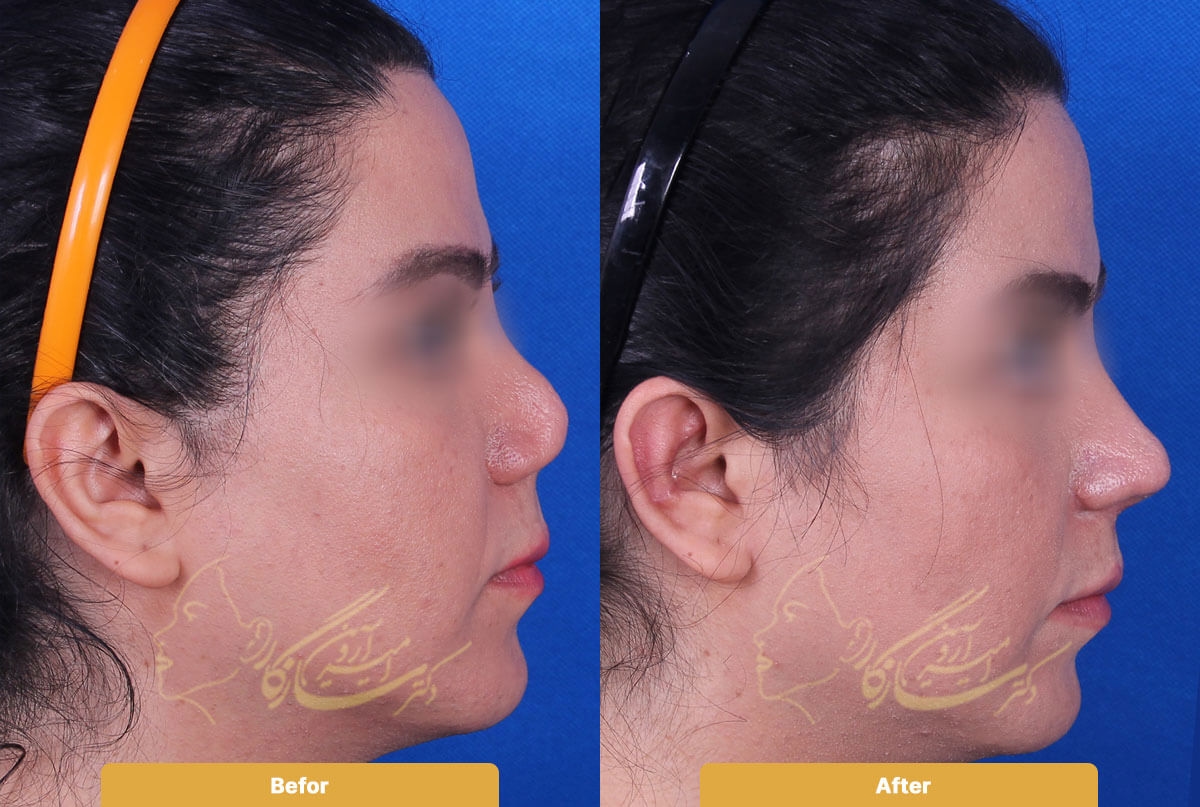 Before and after image