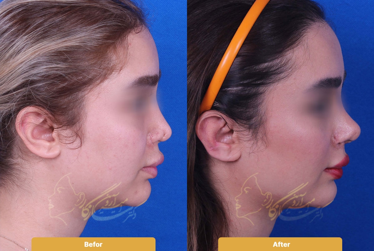 Before and after image