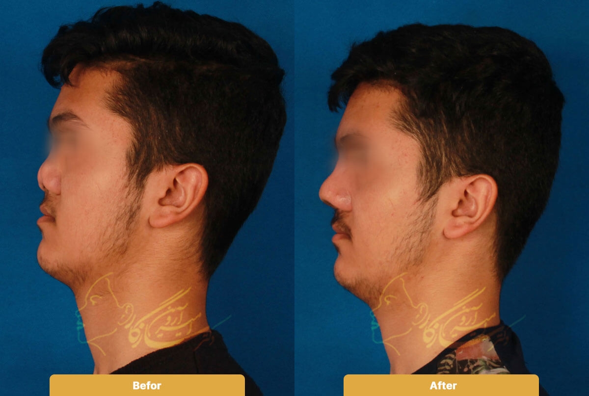 Before and after image