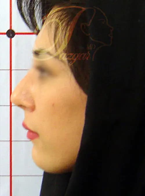 Gallery Image 0-1