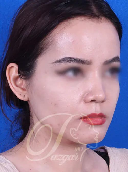 Gallery Image 1-0
