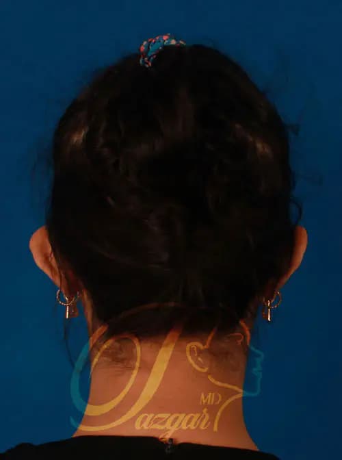 Gallery Image 2-2